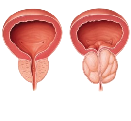 Breast Reconstructive Procedures
